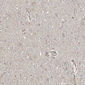 Anti-EHHADH antibody produced in rabbit Prestige Antibodies&#174; Powered by Atlas Antibodies, affinity isolated antibody, buffered aqueous glycerol solution