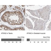 Anti-ATXN2 antibody produced in rabbit affinity isolated antibody, buffered aqueous glycerol solution, Ab3