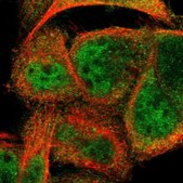 Anti-CCDC22 antibody produced in rabbit Prestige Antibodies&#174; Powered by Atlas Antibodies, affinity isolated antibody, buffered aqueous glycerol solution