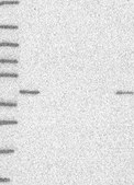 Anti-SSBP2 antibody produced in rabbit Prestige Antibodies&#174; Powered by Atlas Antibodies, affinity isolated antibody, buffered aqueous glycerol solution