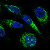Anti-MRPL23 antibody produced in rabbit Prestige Antibodies&#174; Powered by Atlas Antibodies, affinity isolated antibody, buffered aqueous glycerol solution