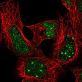 Anti-HOXA4 antibody produced in rabbit Prestige Antibodies&#174; Powered by Atlas Antibodies, affinity isolated antibody, buffered aqueous glycerol solution