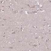 Anti-NOG antibody produced in rabbit Prestige Antibodies&#174; Powered by Atlas Antibodies, affinity isolated antibody, buffered aqueous glycerol solution