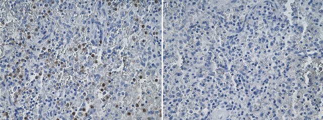 Anti-CXCR2/IL-8RB Antibody, clone 2D18 ZooMAb&#174; Rabbit Monoclonal recombinant, expressed in HEK 293 cells