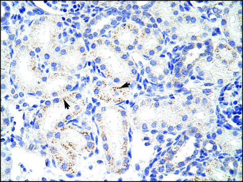 Anti-SNRPA1 antibody produced in rabbit IgG fraction of antiserum