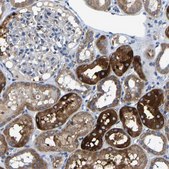 Anti-AGK antibody produced in rabbit Prestige Antibodies&#174; Powered by Atlas Antibodies, affinity isolated antibody, buffered aqueous glycerol solution
