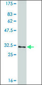 Monoclonal Anti-GGTLA1, (C-terminal) antibody produced in mouse clone 3E10, ascites fluid