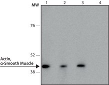 Monoclonal Anti-Actin, &#945;-Smooth Muscle - Peroxidase antibody produced in mouse clone 1A4, purified from hybridoma cell culture