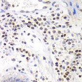 Anti-SMARCA4 antibody produced in rabbit