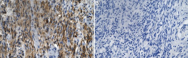 Anti-Neuropilin-2 Antibody, clone 1D15 ZooMAb&#174; Rabbit Monoclonal recombinant, expressed in HEK 293 cells