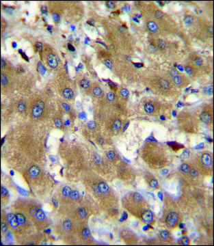 ANTI-HPR (CENTER) antibody produced in rabbit IgG fraction of antiserum, buffered aqueous solution