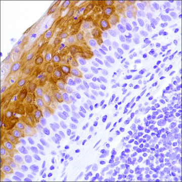 Anti-Keratin 4 antibody, Rabbit monoclonal clone SP210, recombinant, expressed in proprietary host, affinity isolated antibody