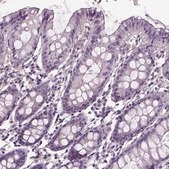 Anti-PEA15 Prestige Antibodies&#174; Powered by Atlas Antibodies, affinity isolated antibody