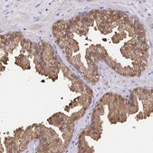 Anti-IDH1 antibody produced in rabbit Prestige Antibodies&#174; Powered by Atlas Antibodies, affinity isolated antibody, buffered aqueous glycerol solution