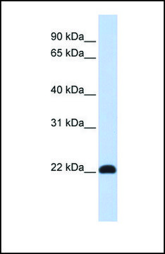 Anti-KLF16, (N-terminal) antibody produced in rabbit affinity isolated antibody