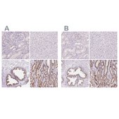 Anti-GALNT7 antibody produced in rabbit Prestige Antibodies&#174; Powered by Atlas Antibodies, affinity isolated antibody, buffered aqueous glycerol solution
