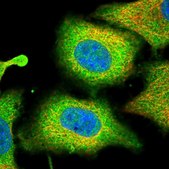 Anti-PLA2G4A antibody produced in rabbit Prestige Antibodies&#174; Powered by Atlas Antibodies, affinity isolated antibody, buffered aqueous glycerol solution