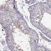 Anti-SPAG17 antibody produced in rabbit Prestige Antibodies&#174; Powered by Atlas Antibodies, affinity isolated antibody, buffered aqueous glycerol solution, ab2