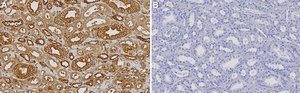 Anti-ARPC5 Antibody, clone 1H16 ZooMAb&#174; Rabbit Monoclonal recombinant, expressed in HEK 293 cells