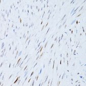 Anti-P21 antibody produced in rabbit