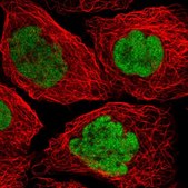 Anti-p53 antibody produced in rabbit Prestige Antibodies&#174; Powered by Atlas Antibodies, affinity isolated antibody