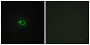 Anti-Collagen XII &#945;1 antibody produced in rabbit affinity isolated antibody