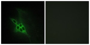 Anti-EPHB1 antibody produced in rabbit affinity isolated antibody