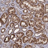 Anti-HSPD1 antibody produced in rabbit Prestige Antibodies&#174; Powered by Atlas Antibodies, affinity isolated antibody, buffered aqueous glycerol solution