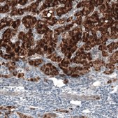 Monoclonal Anti-AMACR antibody produced in mouse Prestige Antibodies&#174; Powered by Atlas Antibodies, clone CL9362, purified immunoglobulin, buffered aqueous glycerol solution
