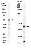 Anti-Wilms Tumor (WT33) from rabbit, purified by affinity chromatography