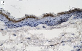Anti-Collagen Type VII Antibody, clone NP32 ZooMAb&#174; Mouse Monoclonal recombinant, expressed in HEK 293 cells