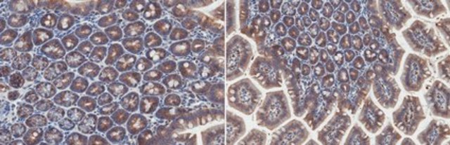 Anti-Cytokeratin-20 Antibody, clone XQ1 clone XQ1, from mouse