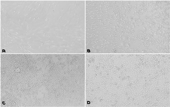 Fibronectin/Gelatin Coating Solution 0.2 &#956;m filtered, BioReagent, suitable for cell culture, Ready-to-use mixture