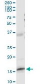 Anti-FABP5 antibody produced in rabbit purified immunoglobulin, buffered aqueous solution