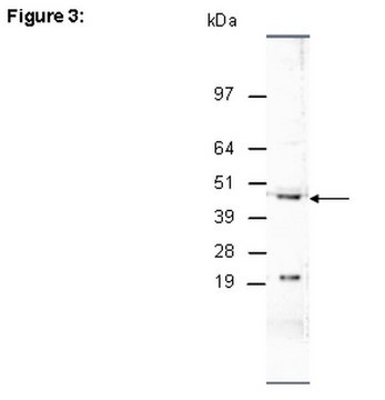 ChIPAb+ JMJD1C - ChIP Validated Antibody and Primer Set from rabbit, purified by affinity chromatography