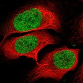 Anti-HMG20A antibody produced in rabbit Prestige Antibodies&#174; Powered by Atlas Antibodies, affinity isolated antibody, buffered aqueous glycerol solution