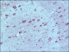 Anti-MAP2 (2a+2b) antibody, Mouse monoclonal ~2&#160;mg/mL, clone AP-20, purified from hybridoma cell culture