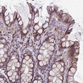 Anti-RAC1 antibody produced in rabbit Prestige Antibodies&#174; Powered by Atlas Antibodies, affinity isolated antibody, buffered aqueous glycerol solution