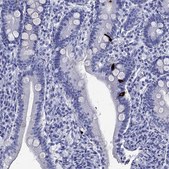 Anti-GIP antibody produced in rabbit Prestige Antibodies&#174; Powered by Atlas Antibodies, affinity isolated antibody, buffered aqueous glycerol solution
