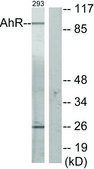 Anti-AHR antibody produced in rabbit affinity isolated antibody