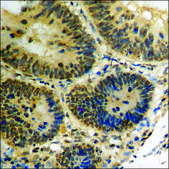 Anti-phospho-PKR (pThr258) antibody produced in rabbit affinity isolated antibody