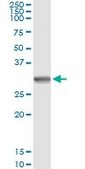 Monoclonal Anti-SNAI1 antibody produced in mouse clone 1A5, purified immunoglobulin, buffered aqueous solution