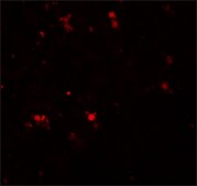 Anti-ELOVL7 antibody produced in rabbit affinity isolated antibody, buffered aqueous solution