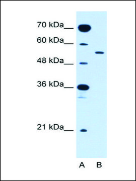 Anti-SLC2A10 antibody produced in rabbit IgG fraction of antiserum