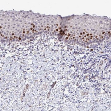 Anti-SETD7 antibody produced in rabbit Prestige Antibodies&#174; Powered by Atlas Antibodies, affinity isolated antibody, buffered aqueous glycerol solution