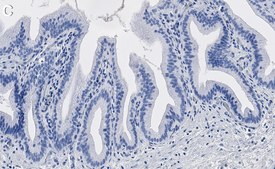 Anti-Parkin Antibody, clone 2J8 ZooMAb&#174; Rabbit Monoclonal recombinant, expressed in HEK 293 cells