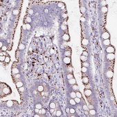 Anti-LIPA antibody produced in rabbit Prestige Antibodies&#174; Powered by Atlas Antibodies, affinity isolated antibody, buffered aqueous glycerol solution