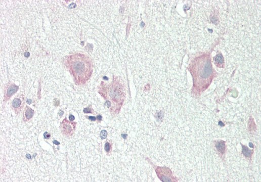 Anti-DLG2 antibody produced in rabbit affinity isolated antibody