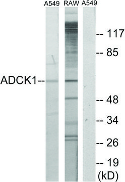 Anti-ADCK1 antibody produced in rabbit affinity isolated antibody