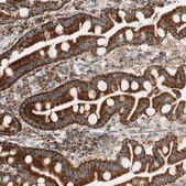 Anti-TOMM20 antibody produced in rabbit Prestige Antibodies&#174; Powered by Atlas Antibodies, affinity isolated antibody, buffered aqueous glycerol solution